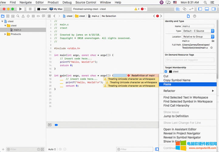 �� OneNote ճ�N���a�� Xcode���l(f��)�F(xi��n)���a�e�`