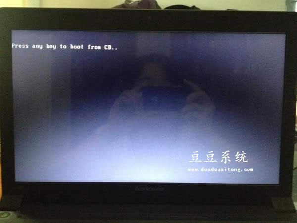 ��������A�T��P���bϵ�y